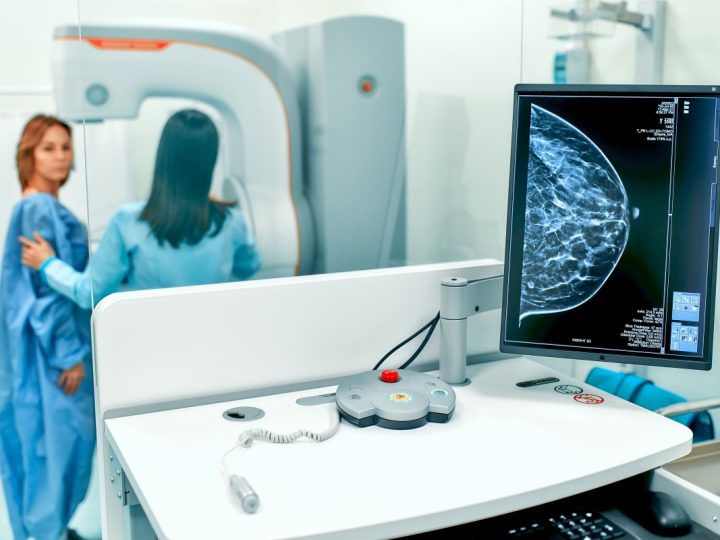 World-leading AI trial to tackle breast cancer launched