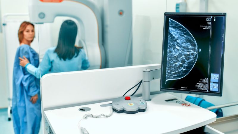 World-leading AI trial to tackle breast cancer launched