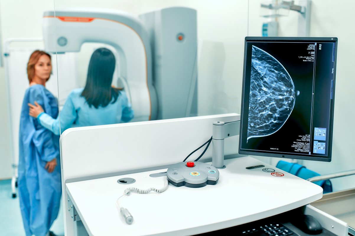 World-leading AI trial to tackle breast cancer launched